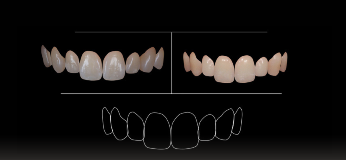 Diseño Digital de la Sonrisa